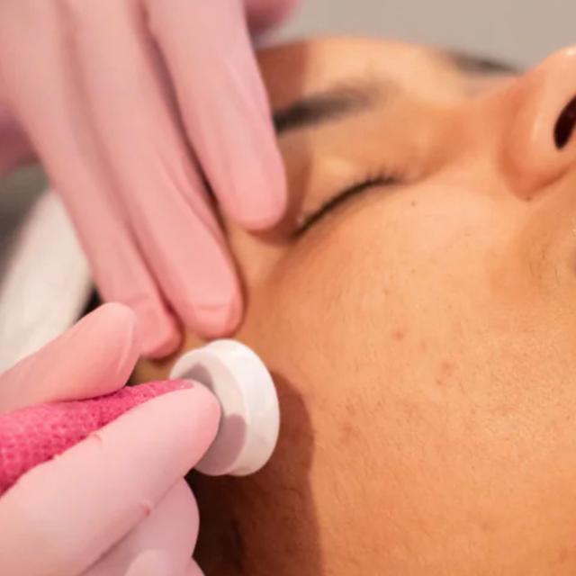 Procell Microchanneling